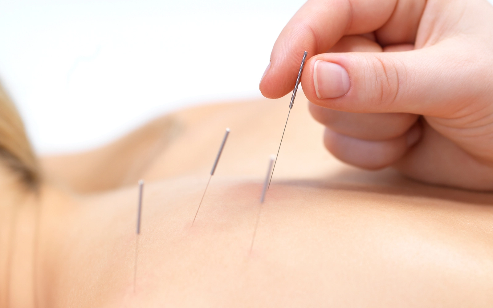 Naturheilkunde - Symbolbild